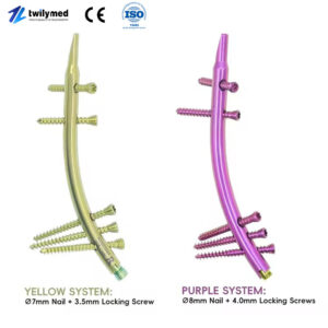 Distal Tibial Intramedullary Nail –Retrograde Fixation