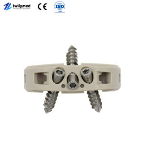 ALIF Anterior Lumbar Interbody Fusion (ALIF)